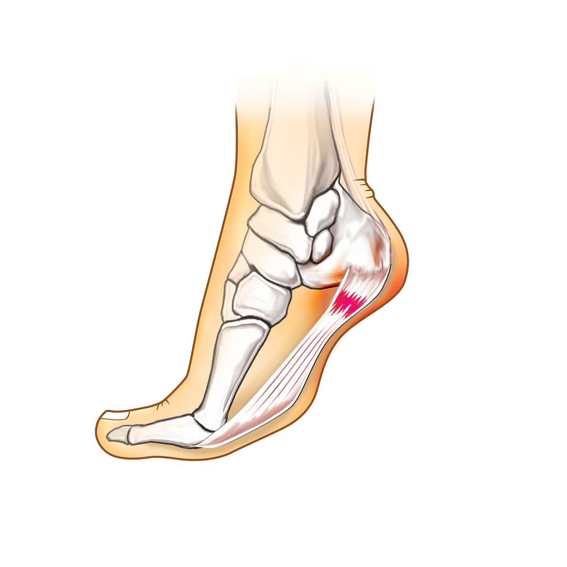 Plantar Fasciitis Slippers Mens